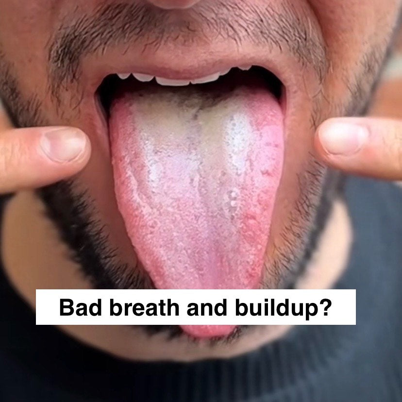 Ayuverdic Copper Tongue Scraper